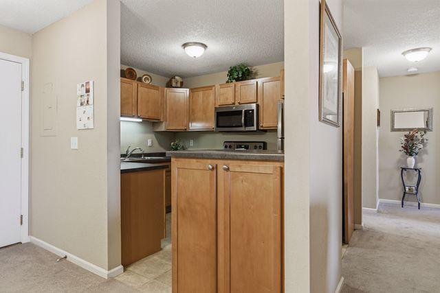 Open KT, view from DR